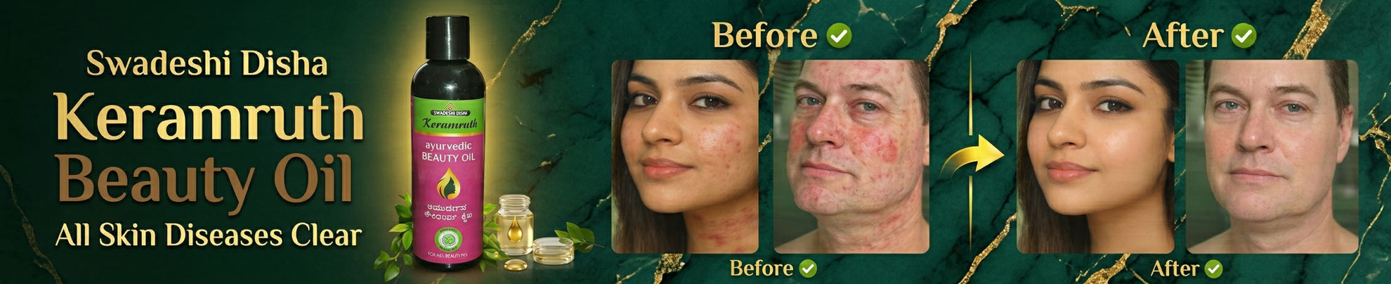 Keramruth beauty oil, Ayurvedic skin oil, natural dark circle remover, stretch mark oil, radiant skin oil, Keramruth, Swadeshi Disha